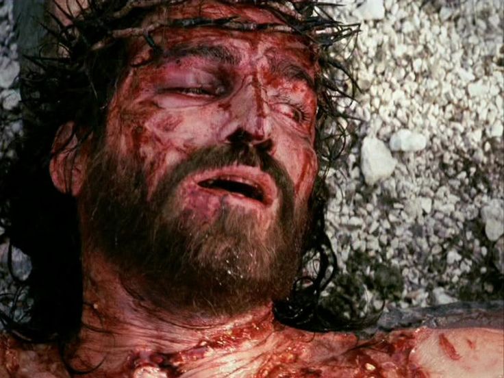 Jesus bled from beard